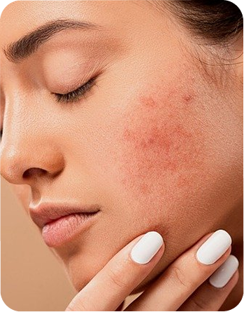 A skin problem that stayed.