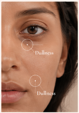 Dullness
