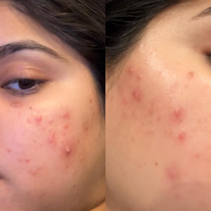 A skin problem that stayed.